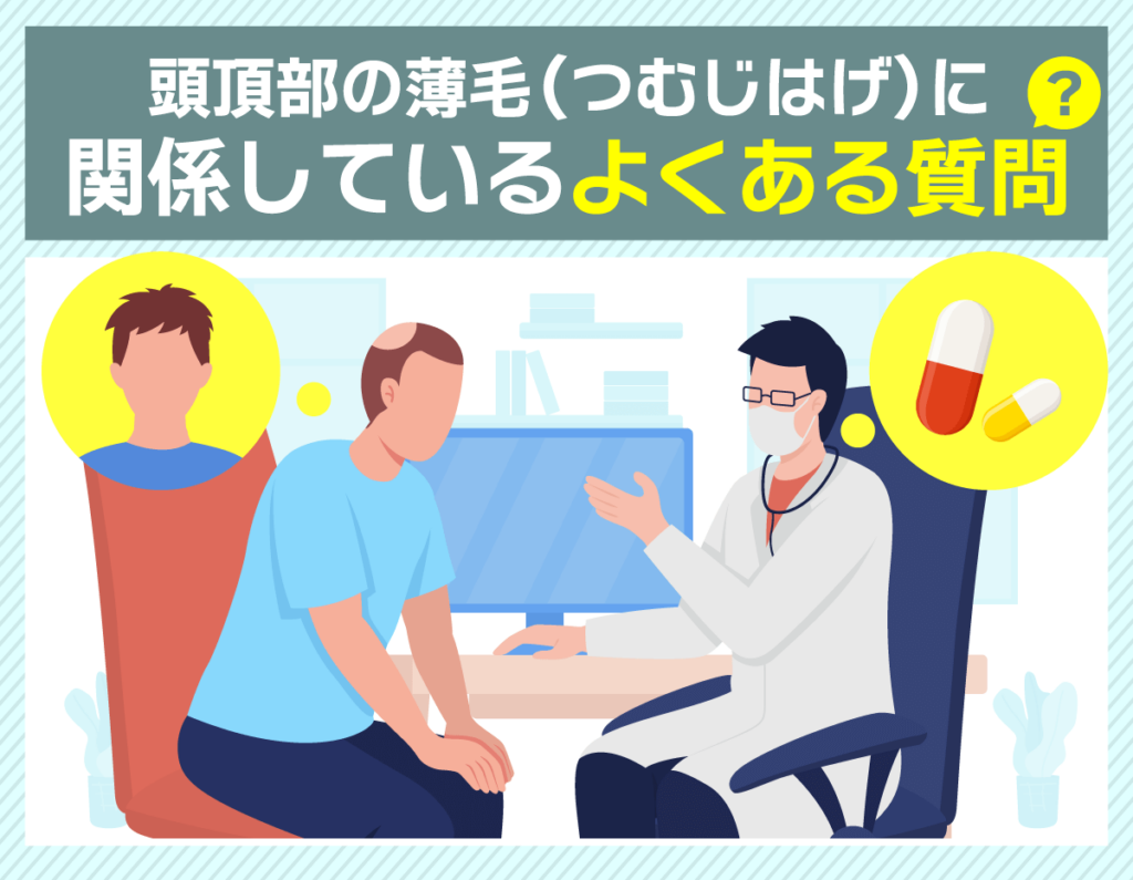 頭頂部薄毛(つむじはげ)に関するよくある質問