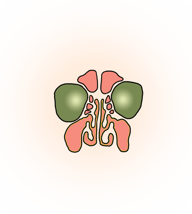 副鼻腔炎（ちくのう症）のイラスト［副鼻腔］