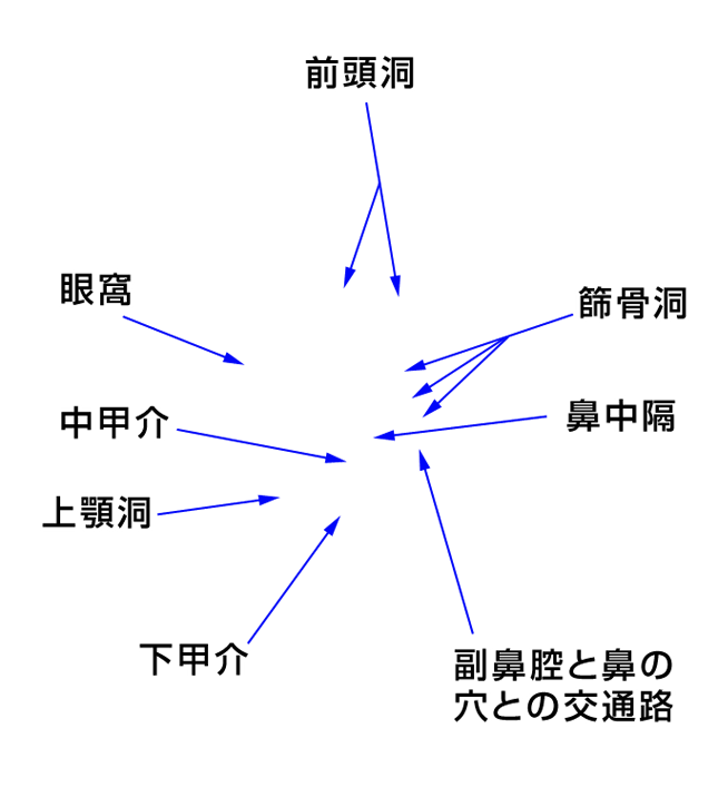 副鼻腔炎（ちくのう症）のイラスト［部位の名称］