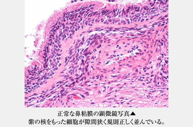 正常な鼻粘膜の顕微鏡写真